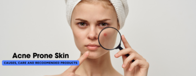 Understanding Acne-Prone Skin: Causes, Care, And Recommended Products Skincare