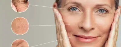 Fine Lines And Wrinkles