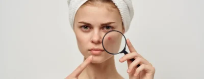 Pimples, Papules, Pustules: A Deep Dive Into The World Of Acne Skincare