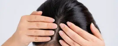 Scalp Shampoo