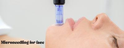 Microneedling For Face