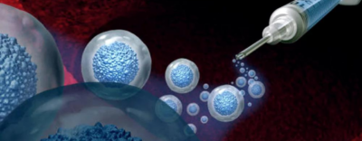 Exosome-Therapy