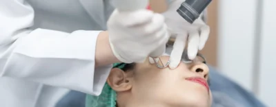 Pico Nd Yag Laser