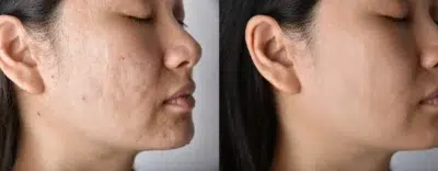 Sebum Control Gel
