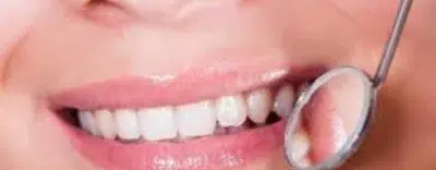 Oral Ulcer
