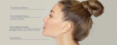 What Are The Fillers And Post Care Of Fillers Aesthetic Procedures