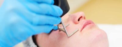 Fractional Co2 Laser
