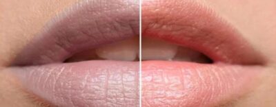 Dark And Pigmented Lips