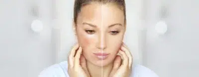 Brightening Cream