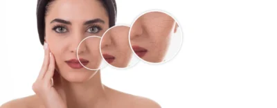 Dry Skin
