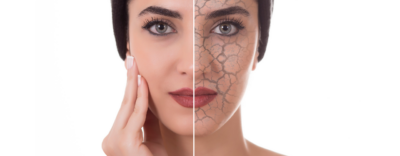 Understanding Dry Skin: Causes, Treatment, And Recommended Products Dermatology