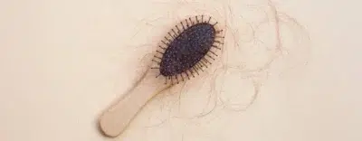 Hair Fall