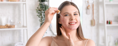 Mandy Mandelic Acid Serum: The Ultimate Solution For Acne Breakouts Skincare