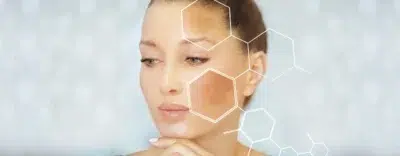 Melasco Melasma Cream: Your Solution For Hyperpigmentation Skincare