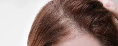 Regrowth