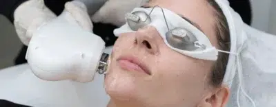 Ipl Plus Rf