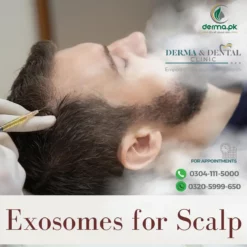 Exosome Therapy