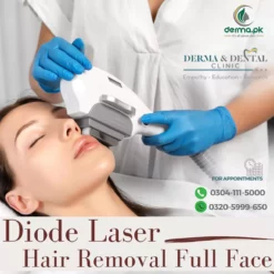 Advanced Diode Laser Hair Removal for Full Face: Expert Dermatologist Treatment
