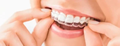 Invisalign