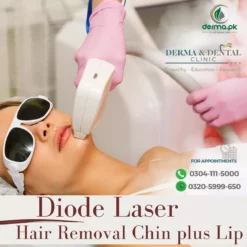 Diode Laser Hair Removal Services: Chin & Lip
