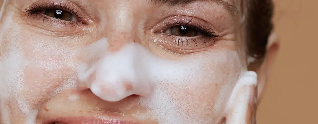 acne wash